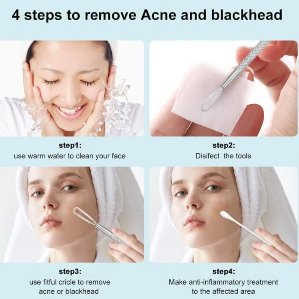 BEAUTÉ SOLINGEN Stainless Steel Blackhead Remover
